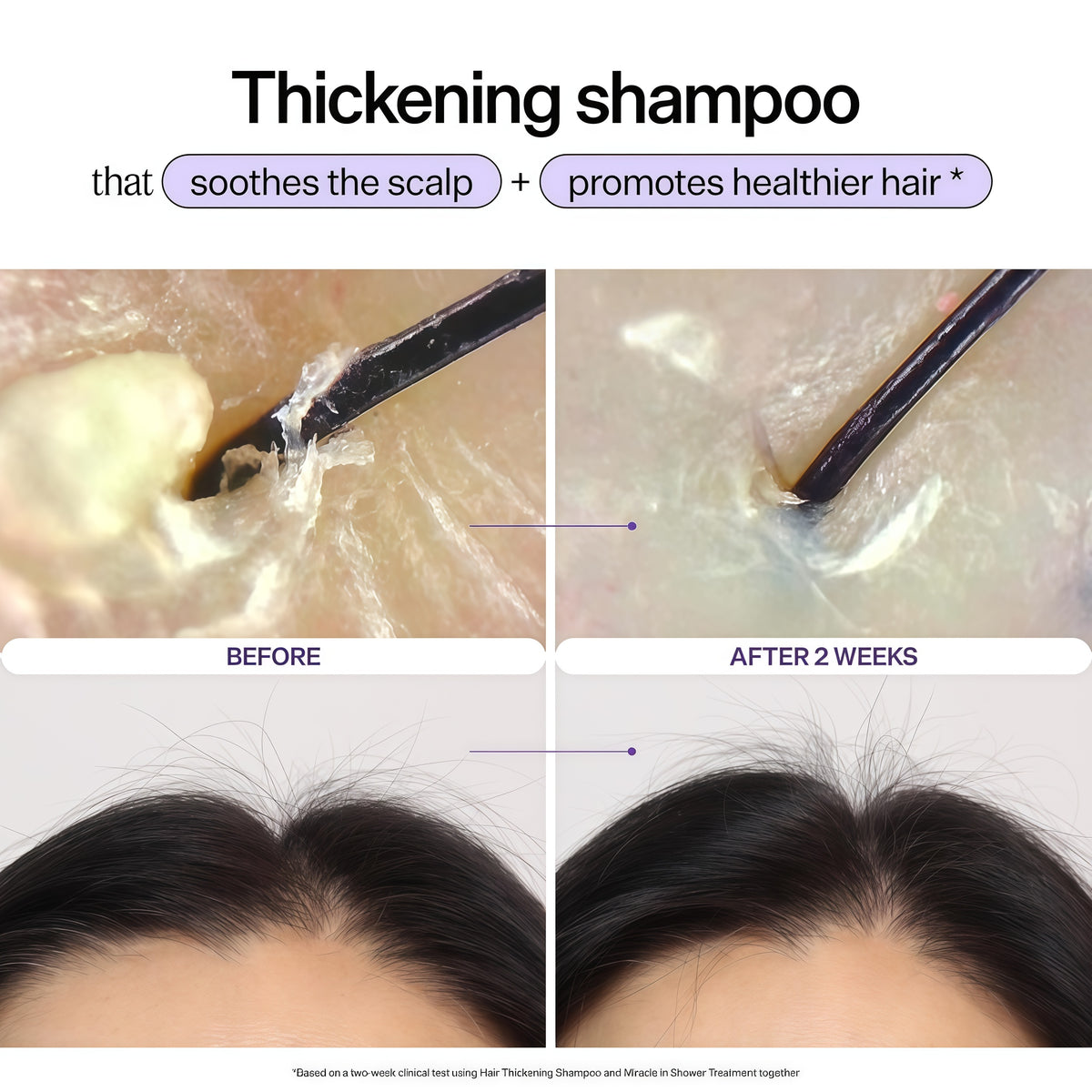 Dr. Groot Miracle in Shower Moisturizing Treatment for Hair Loss, Korean Hair Care Rinse, Rosemary Oil for Smooth, Healthier-Looking Hair in 5 Seconds, Scalp Revitalizing Solution