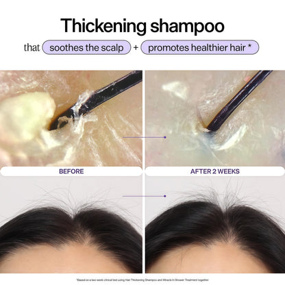 Dr. Groot Miracle in Shower Moisturizing Treatment for Hair Loss, Korean Hair Care Rinse, Rosemary Oil for Smooth, Healthier-Looking Hair in 5 Seconds, Scalp Revitalizing Solution
